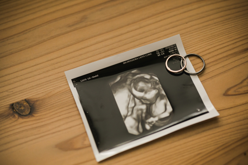 ENISHI PHOTO WEDDING_投稿写真