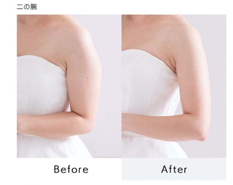 瞬時に美しく見える角度やポージングを判断します。