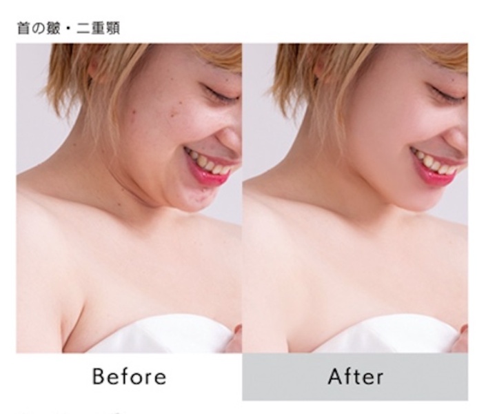 コンプレックスさえも魅力に変える　aim bridal beauty guide