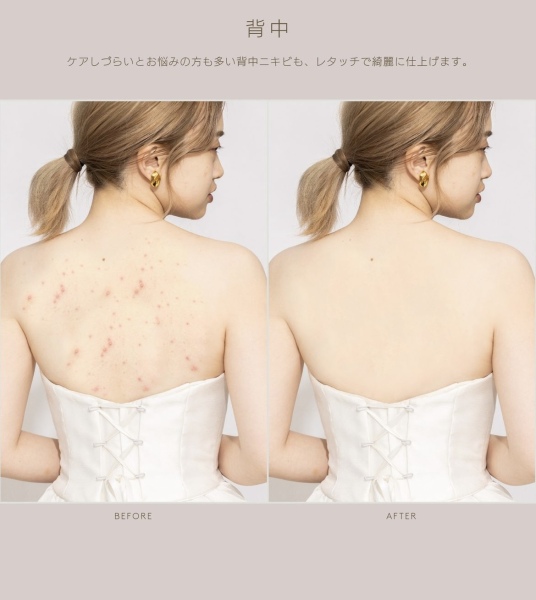 “美”を手に入れる aimのビューティーフォトウェディングをご紹介