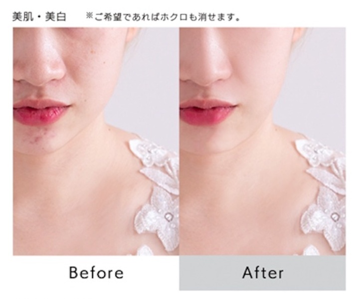 コンプレックスさえも魅力に変える　aim bridal beauty guide