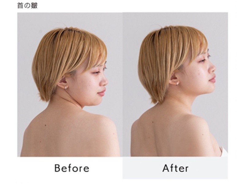 瞬時に美しく見える角度やポージングを判断します。