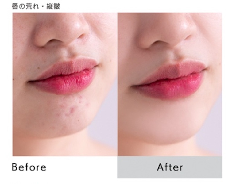 コンプレックスさえも魅力に変える　aim bridal beauty guide
