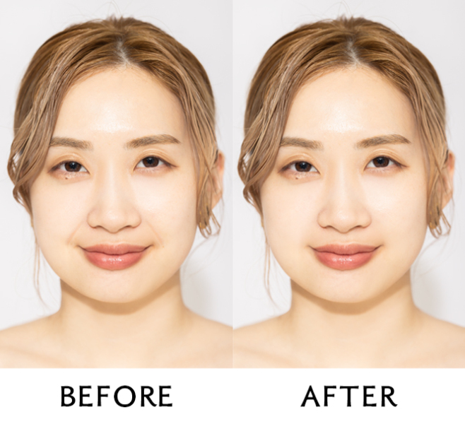 オトナ女子の“気になる”は【ビューティーレタッチ】で解決◎