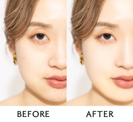 オトナ女子の&ldquo;気になる&rdquo;は【ビューティーレタッチ】で解決◎