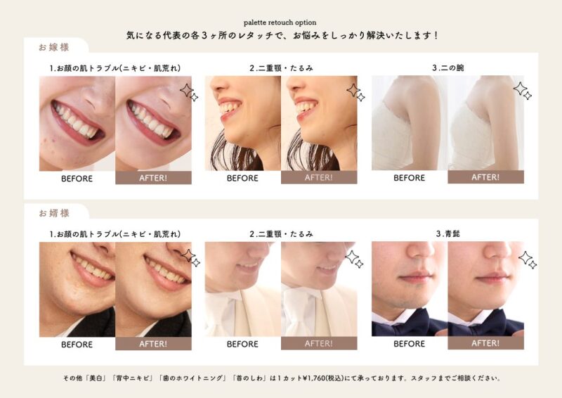 【コンプレックスとさようなら!】パーソナルレタッチが新登場♡