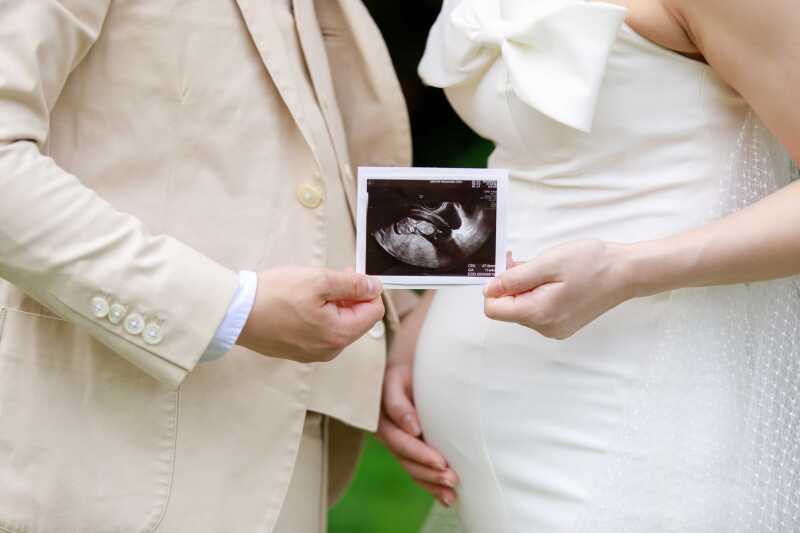 ビーチでのウェディングフォトにイチオシの持込みグッズ10選!