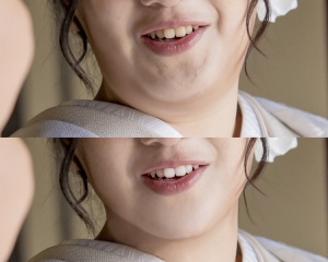 気になる二重顎がスッキリとした小顔に!レタッチのご紹介♪