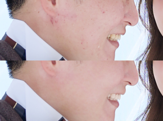 気になるお肌もまるでモデルのように！美肌レタッチのご紹介♪