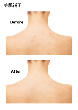 美肌補正につきましてのご案内(^O^)