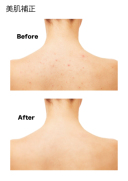 美肌補正について