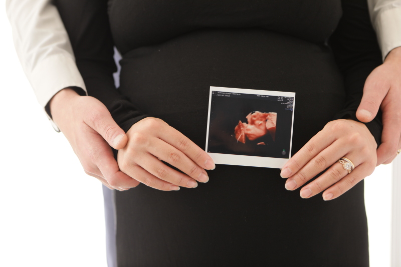 【8・9月限定】マタニティ5カット即日データプラン