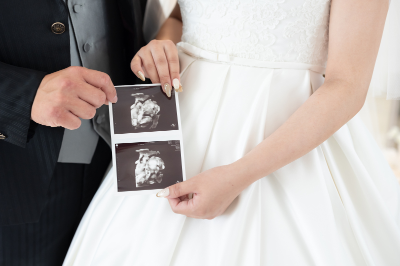 エコー写真を持って撮影