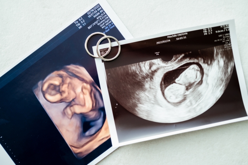 マタニティフォトウエディング!