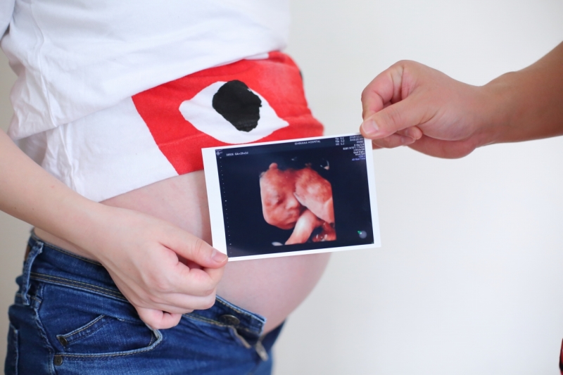 エコー写真と一緒に