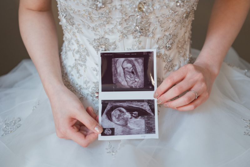 エコー写真と一緒に