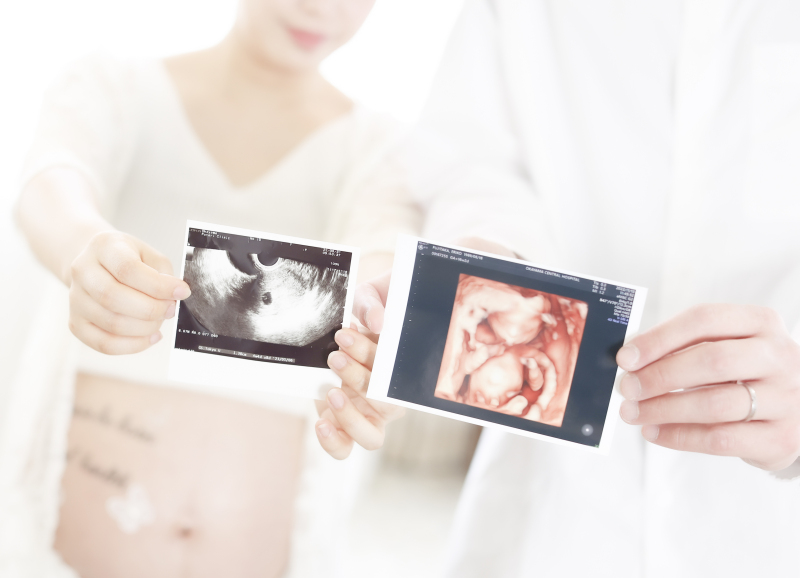 【マタニティーフォト】スタジオフォト|データ20cut+宮参り撮影サービス券