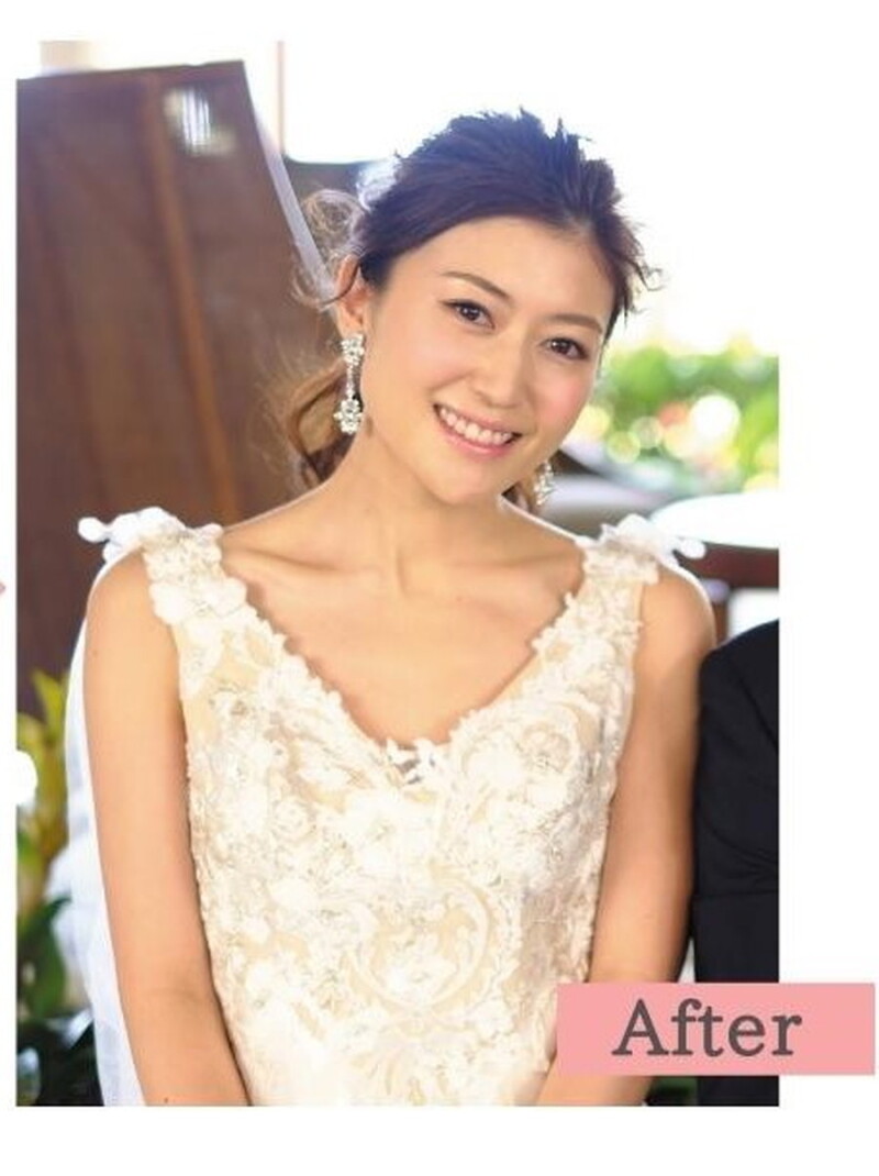ヘアメイクの技術 写真2 after