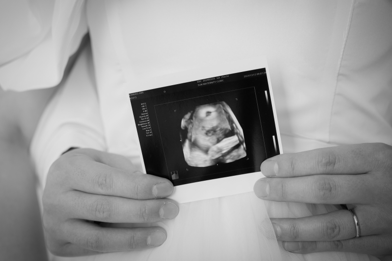 データだけでなく写真にする利点