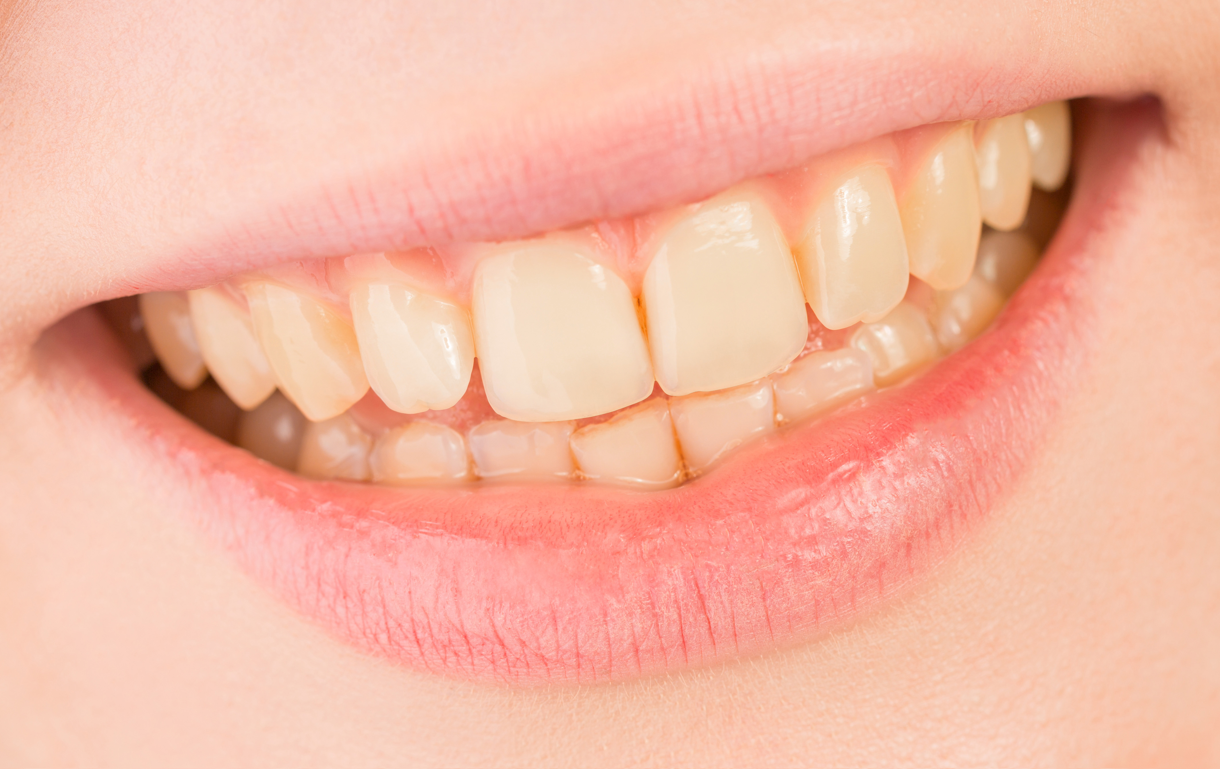 ヘアメイクの技術 写真1 before