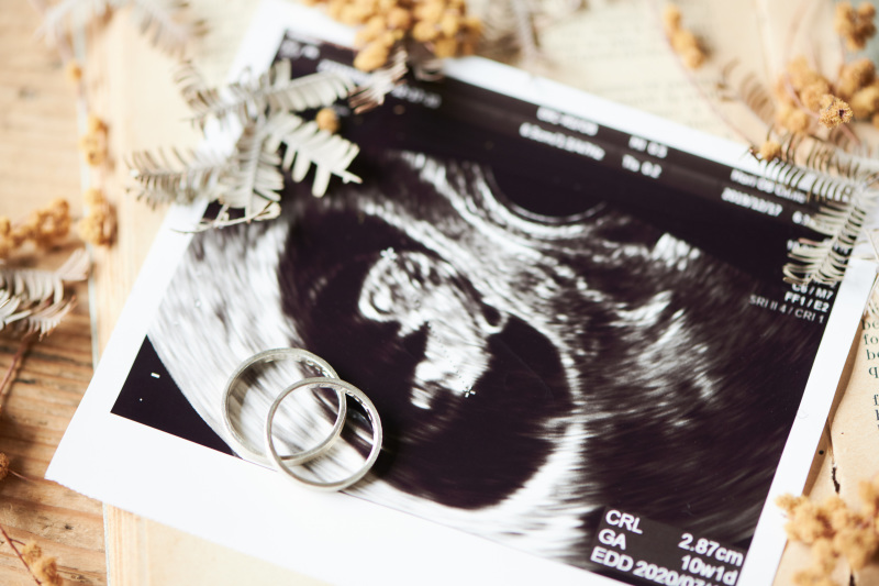 サロンドパルール　salon de parure_マタニティフォトの撮影ができる