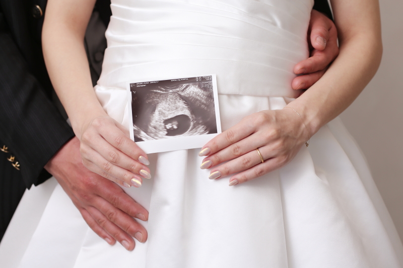 小さな結婚式　仙台店_マタニティフォトの撮影ができる