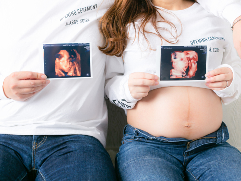 小物のアレンジで世界で一枚のオリジナル写真に。