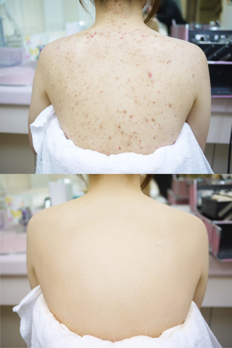 ボディメイクで隅々まで美しく♪