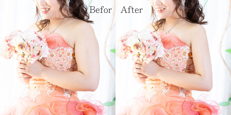 美顔・美ボディ・ 理想を叶えるビューティレタッチ