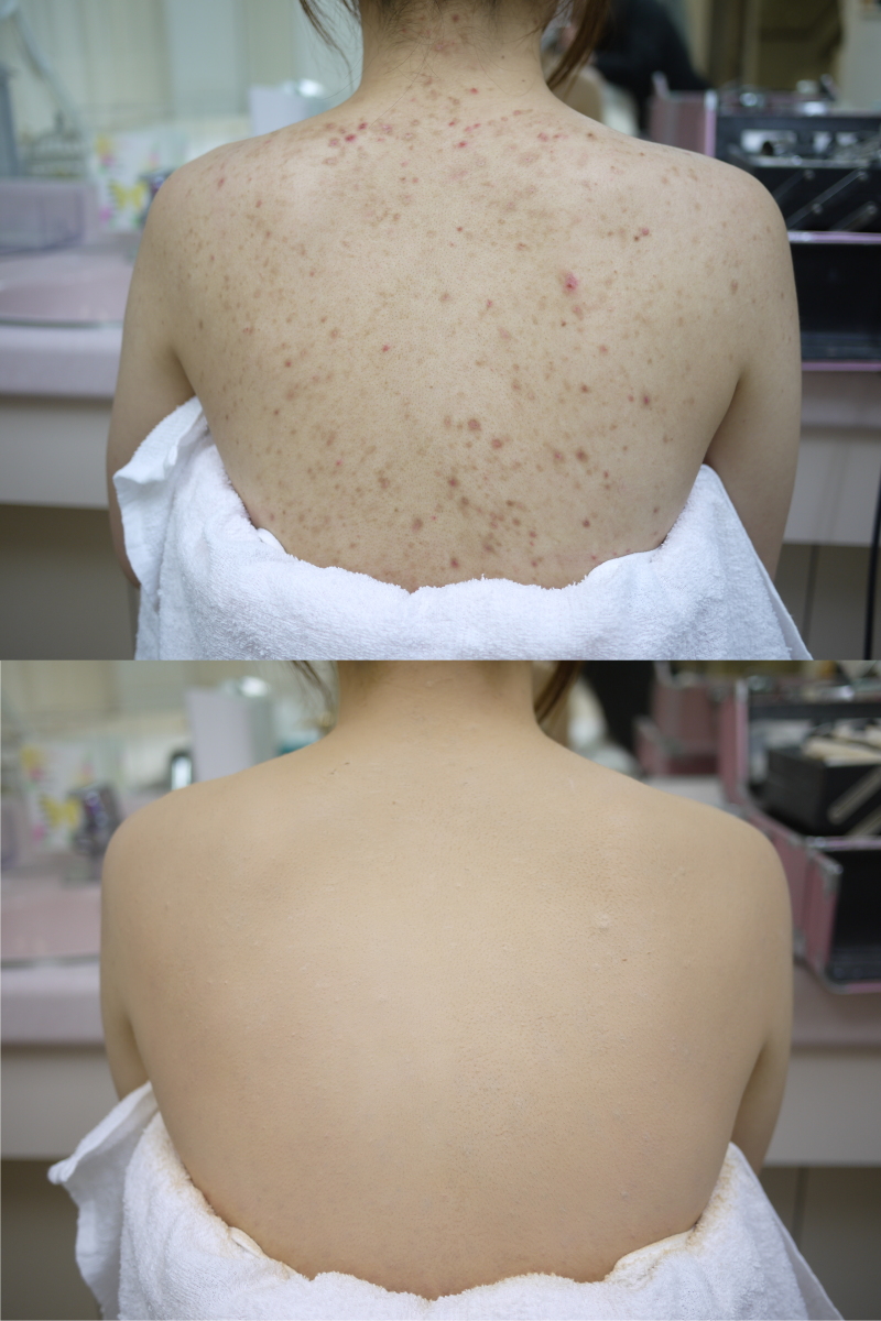 当店オリジナル、ブライダルボディメイクも♪