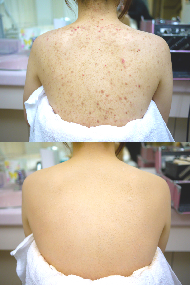 当店オリジナル、ブライダルボディメイクも♪