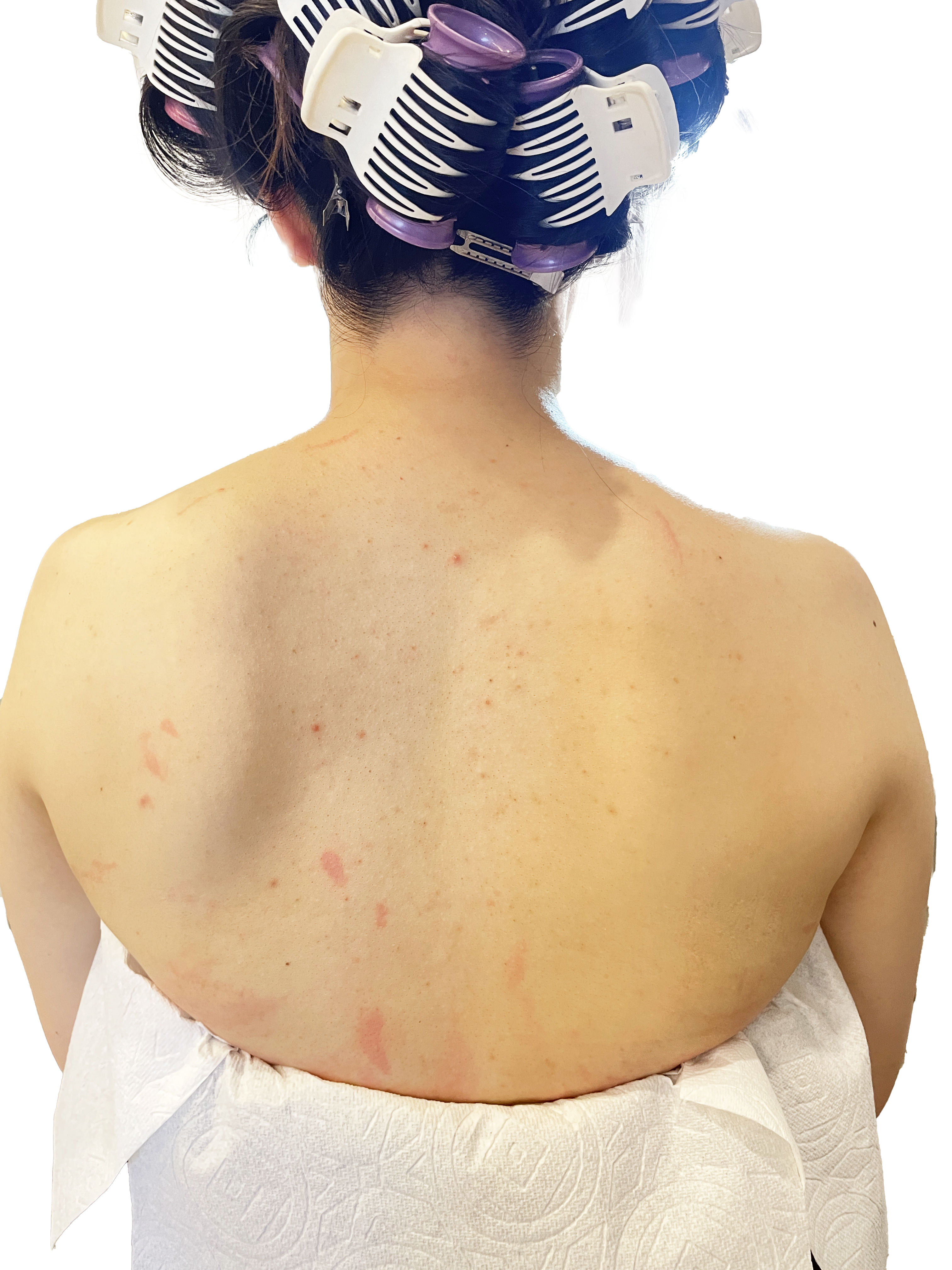 ヘアメイクの技術 写真1 before