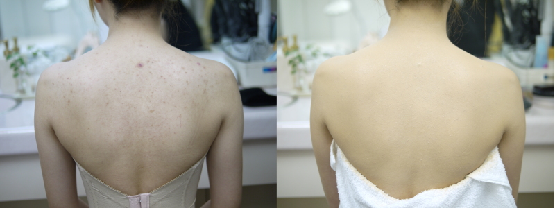 【洋装2着】【ドレス映え美肌シェービング+ボディメイク付】ガーデンロケ＆邸宅貸切♡全データ補正200カット