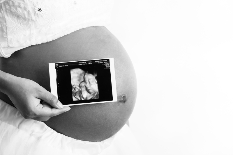 ウェディング×マタニティフォトプラン(データ50カット付き)