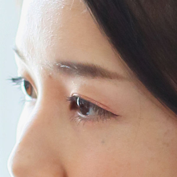 ヘアメイクの技術 写真1 before