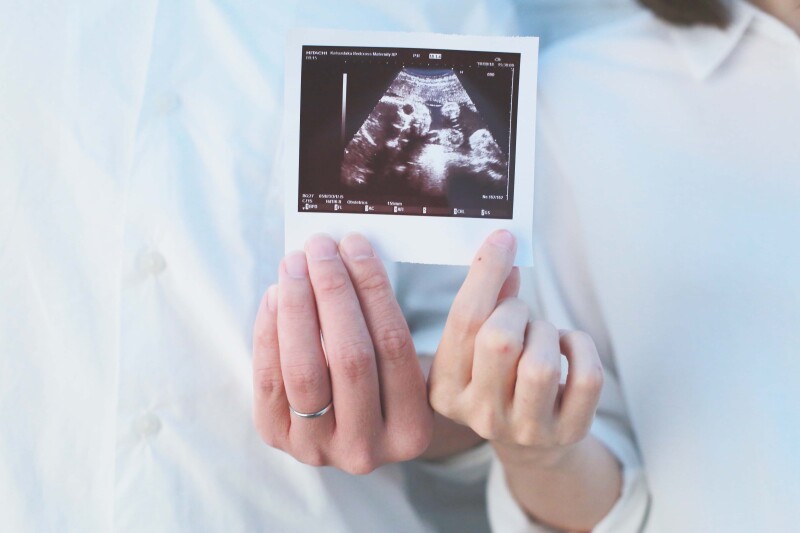 フォトスタジオプリンセス錦糸町_マタニティフォトの撮影ができる