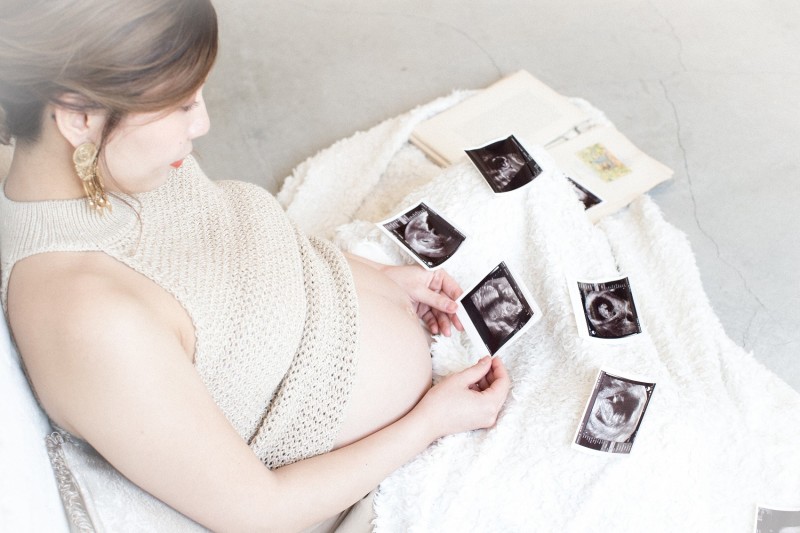 Bonfleur Wedding(ボンフルールウェディング)_マタニティフォトの撮影ができる