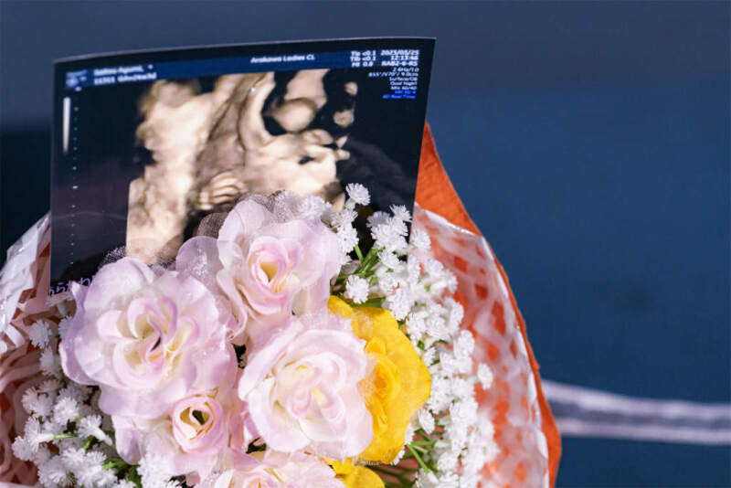 ブーケとエコー写真と一緒に