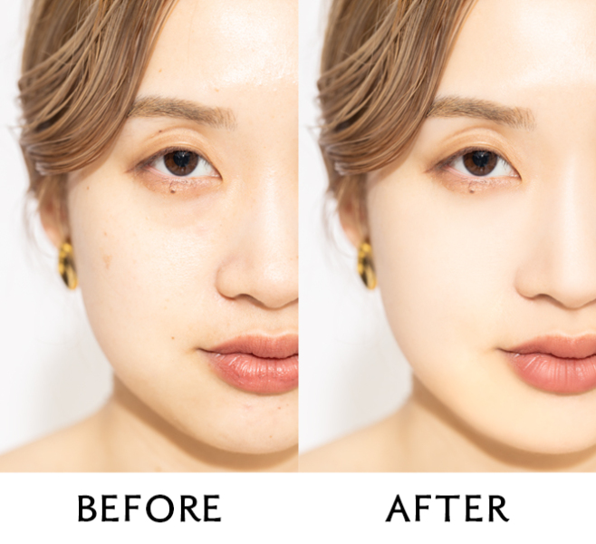 修正ではなく”整える”補正がコンセプト