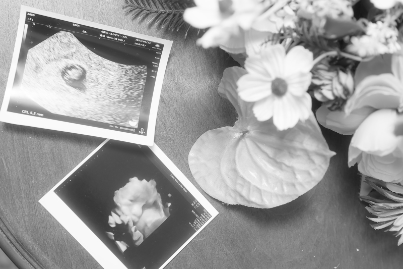 大切なエコー写真を