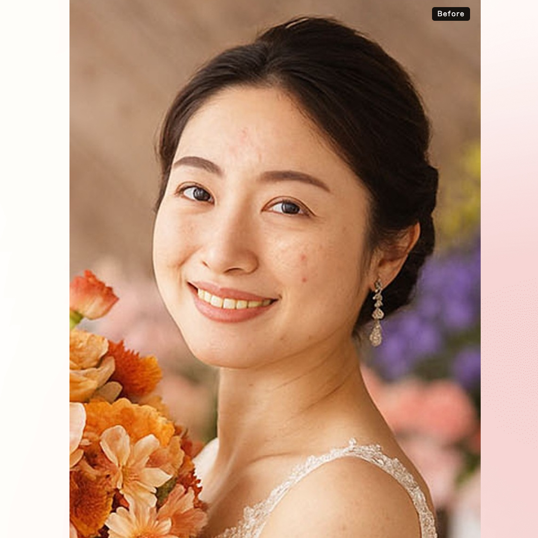 ヘアメイクの技術 写真1 before