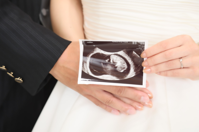 小さな結婚式 大宮店_マタニティフォトの撮影ができる