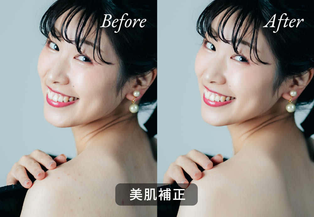 ヘアメイクの技術 写真1 before