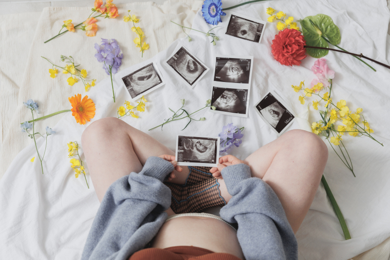 お花とエコー写真をランダムに