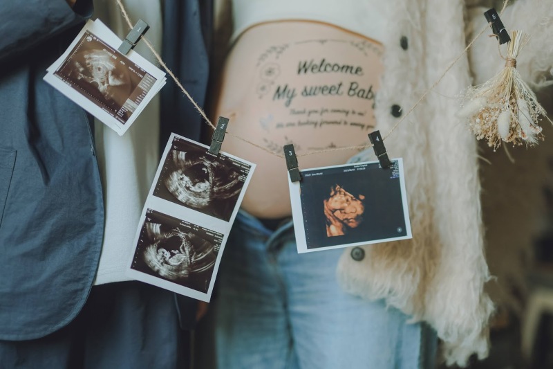 エコー写真をガーランドに。