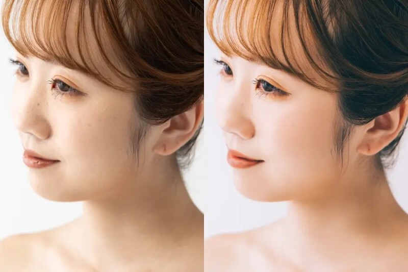 ウェディングフォトこそ修正技術で！