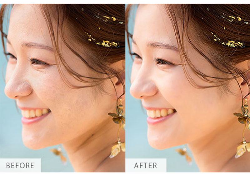 eneen wedding GUNMA_修正技術が自慢