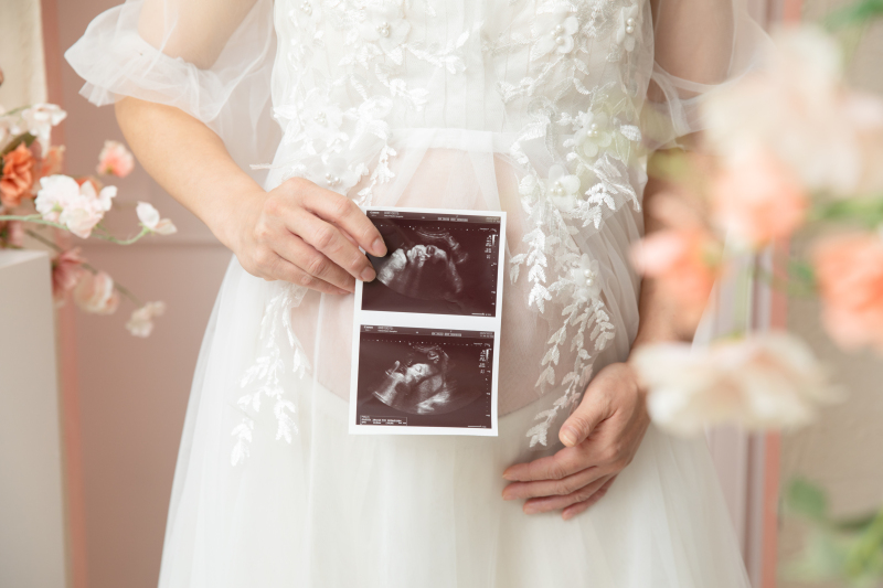 マタニティウェデイングフォト