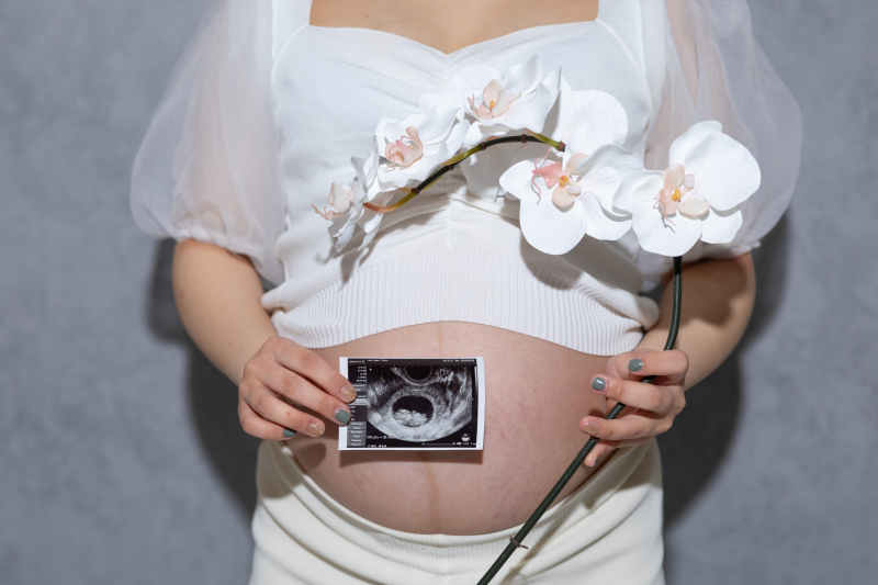 スタンダードプラン