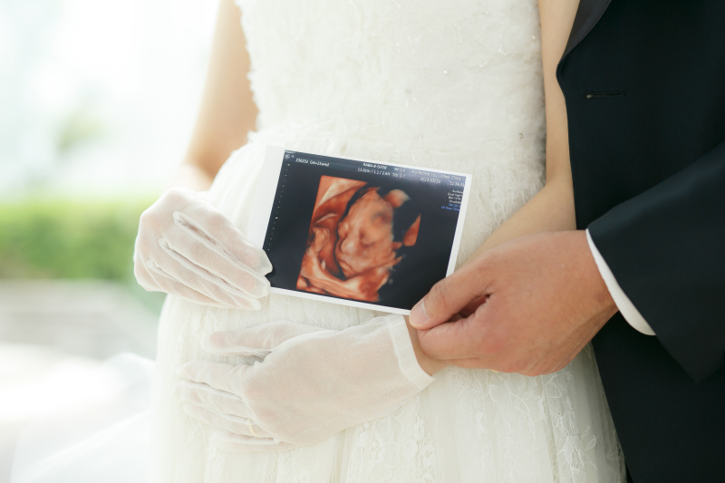 小さな結婚式 福岡店_マタニティフォトの撮影ができる